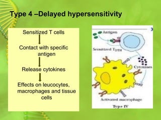 Type 4 –Delayed hypersensitivity
Sensitized T cells
Contact with specific
antigen
Release cytokines
Effects on leucocytes,
macrophages and tissue
cells
 