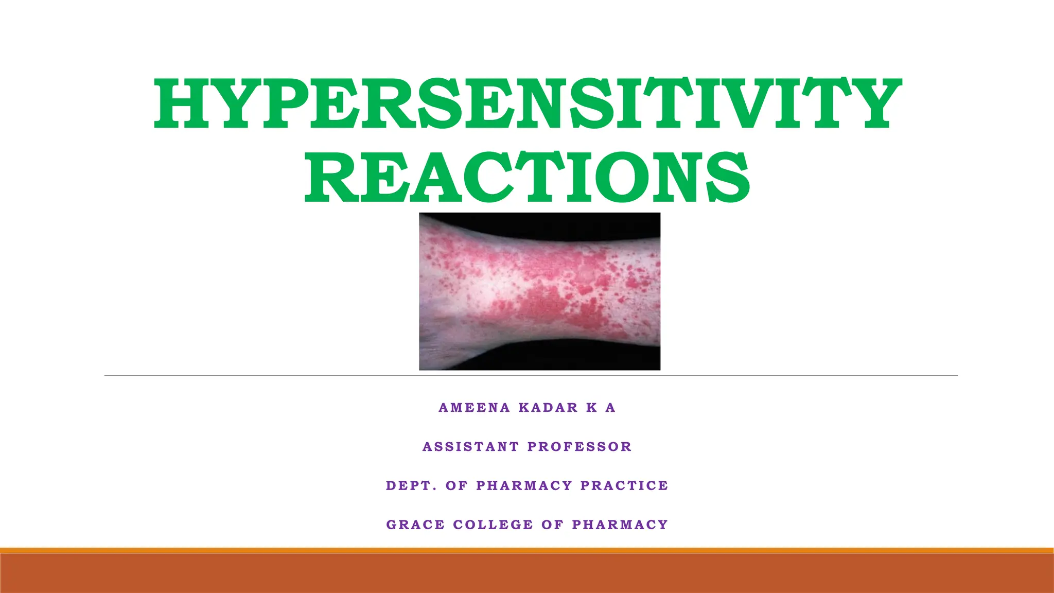 HYPERSENSITIVITY REACTIONS - Pathophysiology Notes for Second Year ...