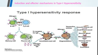 Induction and effecter mechanisms in Type-I Hypersensitivity
 