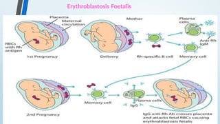 Erythroblastosis Foetalis
 