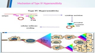 Mechanism of Type IV Hypersensitivity
 