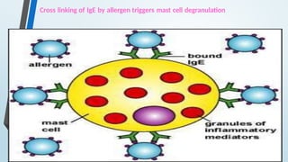 Cross linking of IgE by allergen triggers mast cell degranulation
 