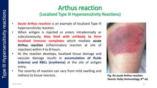 Hypersensitivity Reactions [Autosaved].pdf