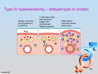 Type IV hypersensitivity – delayed-type or contact
                             T cells (blue cells)
                             that recognize
        Antigen (red dots)   antigen are            Inflammatory
        are processed by     activated and          response causes
        local APCs           release cytokines      tissue injury.




                                                                      155
 