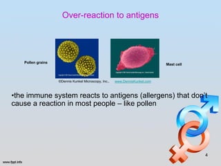 Over-reaction to antigens




   Pollen grains                                                             Mast cell



                   ©Dennis Kunkel Microscopy, Inc.,   www.DennisKunkel.com



•the immune system reacts to antigens (allergens) that don’t
cause a reaction in most people – like pollen




                                                                                         4
 