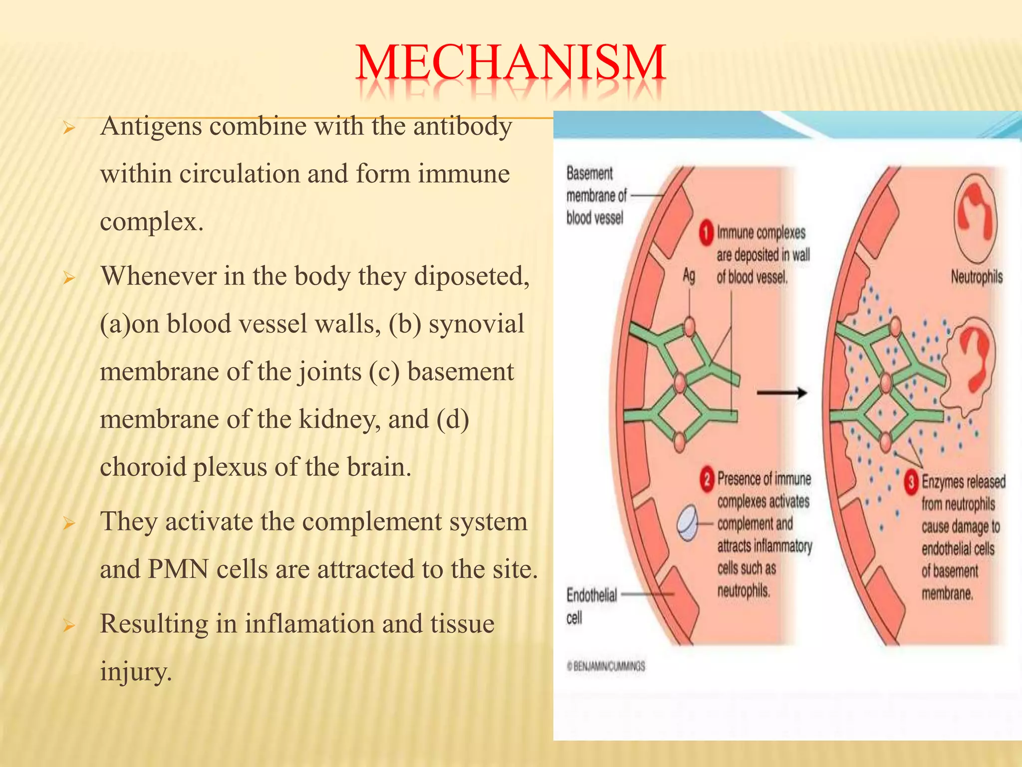 MECHANISM
 Antigens combine with the antibody
within circulation and form immune
complex.
 Whenever in the body they diposeted,
(a)on blood vessel walls, (b) synovial
membrane of the joints (c) basement
membrane of the kidney, and (d)
choroid plexus of the brain.
 They activate the complement system
and PMN cells are attracted to the site.
 Resulting in inflamation and tissue
injury.
 
