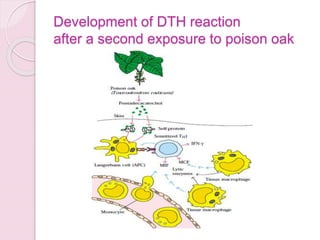 Hypersensitivity allergic reaction | PPTX