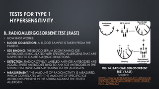 Hypersensitivity Type 1 and Type 2.pptx. | PPTX