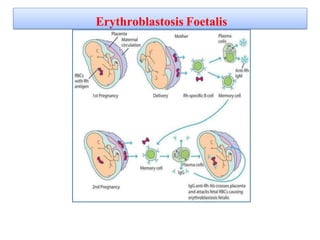 Erythroblastosis Foetalis
 