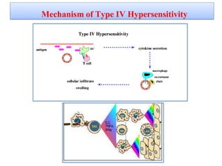 Mechanism of Type IV Hypersensitivity
 