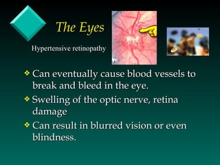 The Eyes
    Hypertensive retinopathy


y Can eventually cause blood vessels to
  break and bleed in the eye.
y Swelling of the optic nerve, retina
  damage
y Can result in blurred vision or even
  blindness.
 