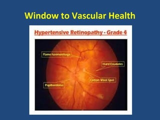 Window to Vascular Health

 