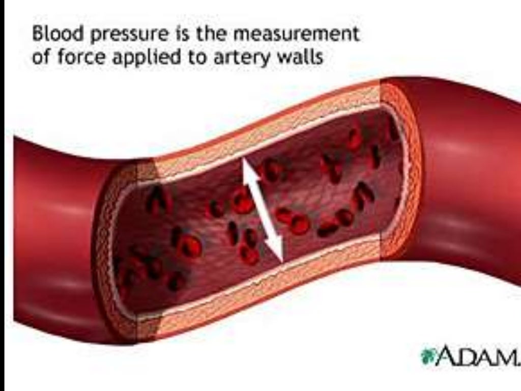 Hypertension Hypertension types causes and management complications c…