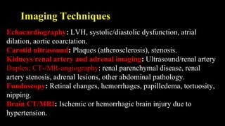 Imaging Techniques
Echocardiography: LVH, systolic/diastolic dysfunction, atrial
dilation, aortic coarctation.
Carotid ultrasound: Plaques (atherosclerosis), stenosis.
Kidneys/renal artery and adrenal imaging: Ultrasound/renal artery
Duplex; CT-/MR-angiography: renal parenchymal disease, renal
artery stenosis, adrenal lesions, other abdominal pathology.
Fundoscopy: Retinal changes, hemorrhages, papilledema, tortuosity,
nipping.
Brain CT/MRI: Ischemic or hemorrhagic brain injury due to
hypertension.
 
