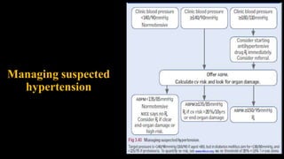 Managing suspected
hypertension
25
 