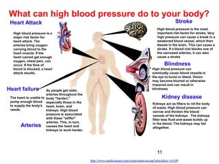 11
What can high blood pressure do to your body?
Heart Attack
High blood pressure is a
major risk factor for
heart attack. The
arteries bring oxygen-
carrying blood to the
heart muscle. If the
heart cannot get enough
oxygen, chest pain, can
occur. If the flow of
blood is blocked, a heart
attack results.
Blindness
High blood pressure can
eventually cause blood vessels in
the eye to burst or bleed. Vision
may become blurred or otherwise
impaired and can result in
blindness
Kidney disease
Kidneys act as filters to rid the body
of waste. High blood pressure can
narrow and thicken the blood
vessels of the kidneys. The kidneys
filter less fluid and waste builds up
in the blood. The kidneys may fail
altogether.
High blood pressure is the most
important risk factor for stroke. Very
high pressure can cause a break in a
weakened blood vessel, which then
bleeds in the brain. This can cause a
stroke. If a blood clot blocks one of
the narrowed arteries, it can also
cause a stroke
Stroke
As people get older,
arteries throughout the
body "harden,"
especially those in the
heart, brain, and
kidneys. High blood
pressure is associated
with these "stiffer"
arteries. This, in turn,
causes the heart and
kidneys to work harder.
Arteries
Heart failure
The heart is unable to
pump enough blood
to supply the body's
needs.
http://www.medicinenet.com/script/main/art.asp?articlekey=16109
 