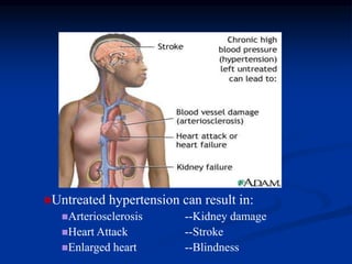 Untreated hypertension can result in:
Arteriosclerosis --Kidney damage
Heart Attack --Stroke
Enlarged heart --Blindness
 