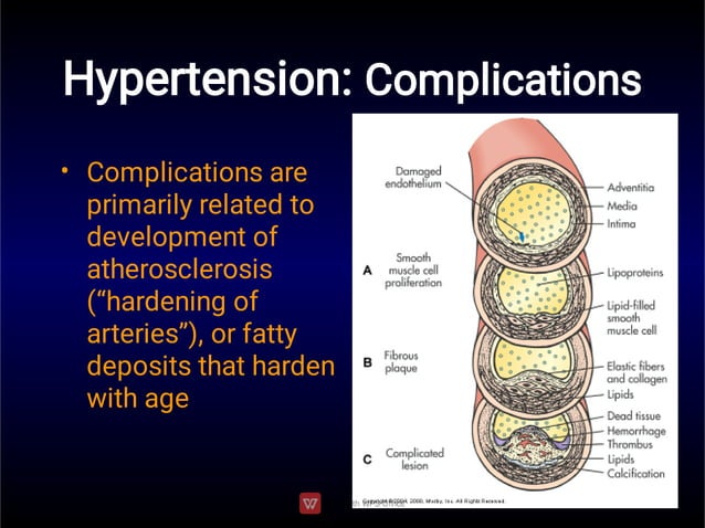 Hypertension pathophysiology | PDF | Heart and Cardiovascular Diseases ...