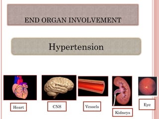 END ORGAN INVOLVEMENT
Hypertension
Eye
Kidneys
Vessels
CNS
Heart
 