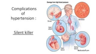 Complications
of
hypertension :
Silent killer
 