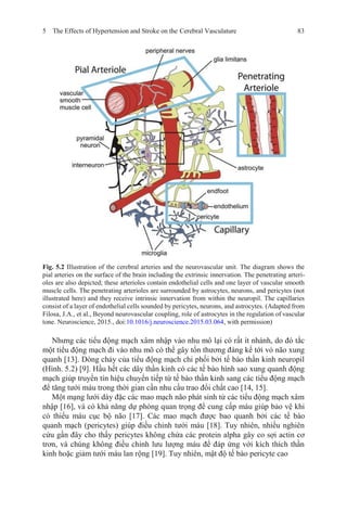 5 The Effects of Hypertension and Stroke on the Cerebral Vasculature 83
Fig. 5.2 Illustration of the cerebral arteries and the neurovascular unit. The diagram shows the
pial arteries on the surface of the brain including the extrinsic innervation. The penetrating arteri-
oles are also depicted; these arterioles contain endothelial cells and one layer of vascular smooth
muscle cells. The penetrating arterioles are surrounded by astrocytes, neurons, and pericytes (not
illustrated here) and they receive intrinsic innervation from within the neuropil. The capillaries
consist of a layer of endothelial cells sounded by pericytes, neurons, and astrocytes. (Adapted from
Filosa, J.A., et al., Beyond neurovascular coupling, role of astrocytes in the regulation of vascular
tone. Neuroscience, 2015., doi:10.1016/j.neuroscience.2015.03.064, with permission)
Nhưng các tiểu động mạch xâm nhập vào nhu mô lại có rất ít nhánh, do đó tắc
một tiểu động mạch đi vào nhu mô có thể gây tổn thương đáng kể tới vỏ não xung
quanh [13]. Dòng chảy của tiểu động mạch chi phối bởi tế bào thần kinh neuropil
(Hình. 5.2) [9]. Hầu hết các dây thần kinh có các tế bào hình sao xung quanh động
mạch giúp truyền tín hiệu chuyển tiếp từ tế bào thần kinh sang các tiểu động mạch
để tăng tưới máu trong thời gian cần nhu cầu trao đổi chất cao [14, 15].
Một mạng lưới dày đặc các mao mạch não phát sinh từ các tiểu động mạch xâm
nhập [16], và có khả năng dự phòng quan trọng để cung cấp máu giúp bảo vệ khi
có thiếu máu cục bộ não [17]. Các mao mạch được bao quanh bởi các tế bào
quanh mạch (pericytes) giúp điều chỉnh tưới máu [18]. Tuy nhiên, nhiều nghiên
cứu gần đây cho thấy pericytes không chứa các protein alpha gây co sợi actin cơ
trơn, và chúng không điều chỉnh lưu lượng máu để đáp ứng với kích thích thần
kinh hoặc giảm tưới máu lan rộng [19]. Tuy nhiên, mật độ tế bào pericyte cao
 