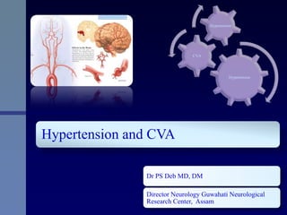 Hypertension and CVA
Dr PS Deb MD, DM
Director Neurology Guwahati Neurological
Research Center, Assam
Hypertension
CVA
Hypertension
 
