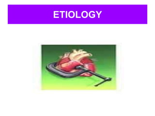 ETIOLOGY
 