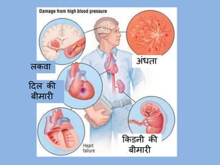 Hypertension health talk- Hindi (उच्च रक्तचाप) | PPTX