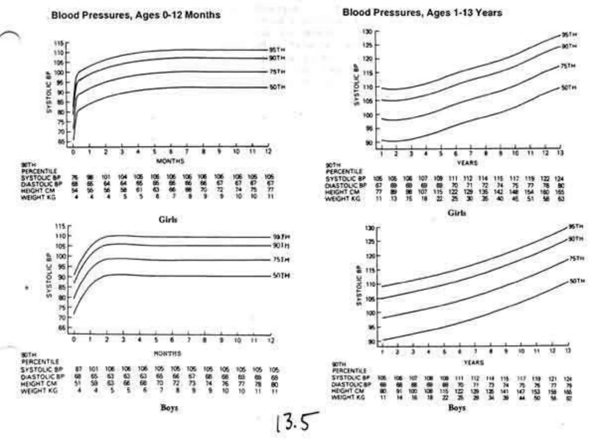 Hypertension in pediatric PPT