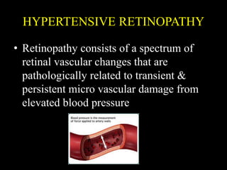 HYPERTENSIVE RETINOPATHY
• Retinopathy consists of a spectrum of
retinal vascular changes that are
pathologically related to transient &
persistent micro vascular damage from
elevated blood pressure
 