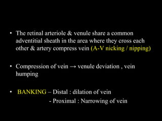 • The retinal arteriole & venule share a common
adventitial sheath in the area where they cross each
other & artery compress vein (A-V nicking / nipping)
• Compression of vein → venule deviation , vein
humping
• BANKING – Distal : dilation of vein
- Proximal : Narrowing of vein
 