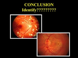 CONCLUSION
Identify?????????
 