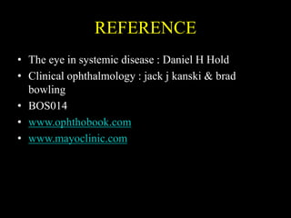 REFERENCE
• The eye in systemic disease : Daniel H Hold
• Clinical ophthalmology : jack j kanski & brad
bowling
• BOS014
• www.ophthobook.com
• www.mayoclinic.com
 