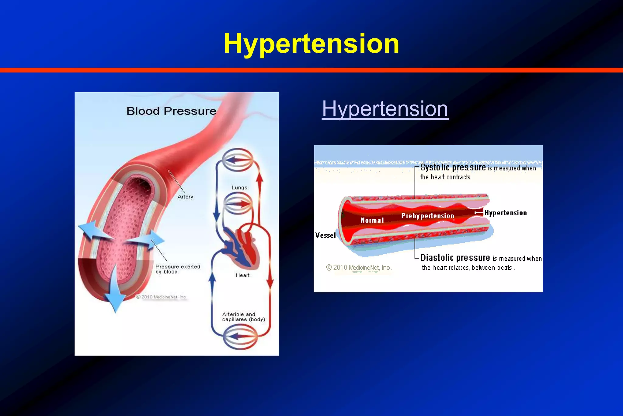 Hypertension pathophysiology PPT