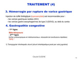 TRAITEMENT (4)
3. Hémorragie par rupture de varice gastrique
Injection de colle biologique (cyanoacrylate) est recommandée...