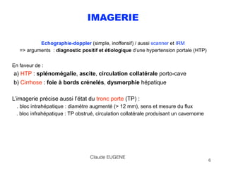 IMAGERIE
Echographie-doppler (simple, inoffensif) / aussi scanner et IRM 
=> arguments : diagnostic positif et étiologique...