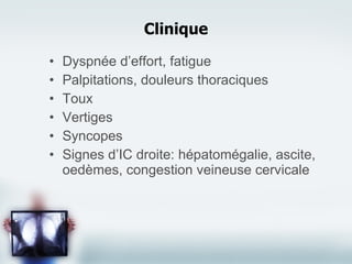 Clinique Dyspnée d’effort, fatigue Palpitations, douleurs thoraciques Toux Vertiges Syncopes Signes d’IC droite: hépatomégalie, ascite, oedèmes, congestion veineuse cervicale 