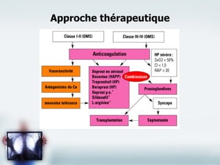 Approche thérapeutique 