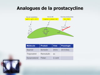 Analogues de la prostacycline Molécule Produit Voie Posologie Iloprost Ilomedin inh/iv inh 6-9x/j Treprostinil Remodulin sc Epoprostenol Flolan iv cont Voie de l’endothéline Voie du NO Voie des prostacyclines ppET-1 – pET-1 – ET-1 L-arginine – L-citruline + NO AA – PGI2 Prostacycline NO ET-1 ET GTP cGMP PDE cAMP ET 