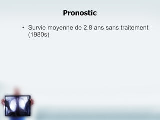 Survie moyenne de 2.8 ans sans traitement (1980s) Pronostic 