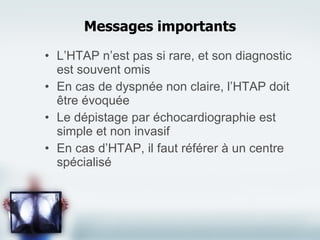 L’HTAP n’est pas si rare, et son diagnostic est souvent omis En cas de dyspnée non claire, l’HTAP doit être évoquée Le dépistage par échocardiographie est simple et non invasif En cas d’HTAP, il faut référer à un centre spécialisé Messages importants 