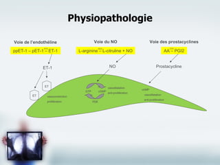 Physiopathologie Voie de l’endothéline Voie du NO Voie des prostacyclines ppET-1 – pET-1 – ET-1 L-arginine – L-citruline + NO AA – PGI2 Prostacycline NO ET-1 ET ET vasoconstriction prolifération GTP cGMP PDE vasodilatation anti-prolifération cAMP vasodilatation anti-prolifération ECE NOS COX 