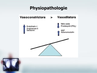 Physiopathologie 