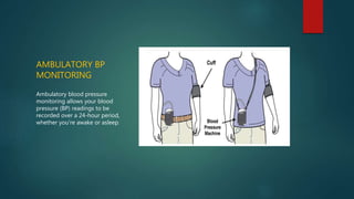 AMBULATORY BP
MONITORING
Ambulatory blood pressure
monitoring allows your blood
pressure (BP) readings to be
recorded over a 24-hour period,
whether you're awake or asleep.
 