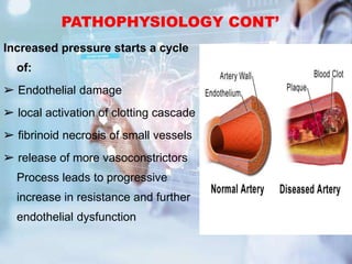 PATHOPHYSIOLOGY CONT’
Increased pressure starts a cycle
of:
➢ Endothelial damage
➢ local activation of clotting cascade
➢ fibrinoid necrosis of small vessels
➢ release of more vasoconstrictors
Process leads to progressive
increase in resistance and further
endothelial dysfunction
 