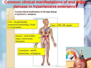 Common clinical manifestations of end organ
damage in hypertensive emergency
 