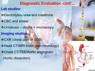 Diagnostic Evaluation cont’...
Lab studies:
❖Electrolytes, urea and creatinine
❖CBC and smear
❖Urinalysis – dipstix + microscopy
Imaging studies
❖CXR (chest pain or SOB)
❖Head CT/MRI brain (abn neurology)
❖Chest CT/TEE/Aortic angiogram
(Aortic dissection)
 