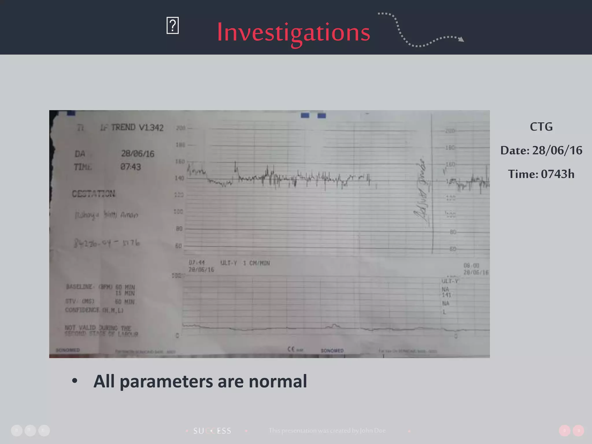 SUCCESS• •• • ThispresentationwascreatedbyJohnDoe •
Investigations
CTG
Date:28/06/16
Time:0743h
• All parameters are normal
 