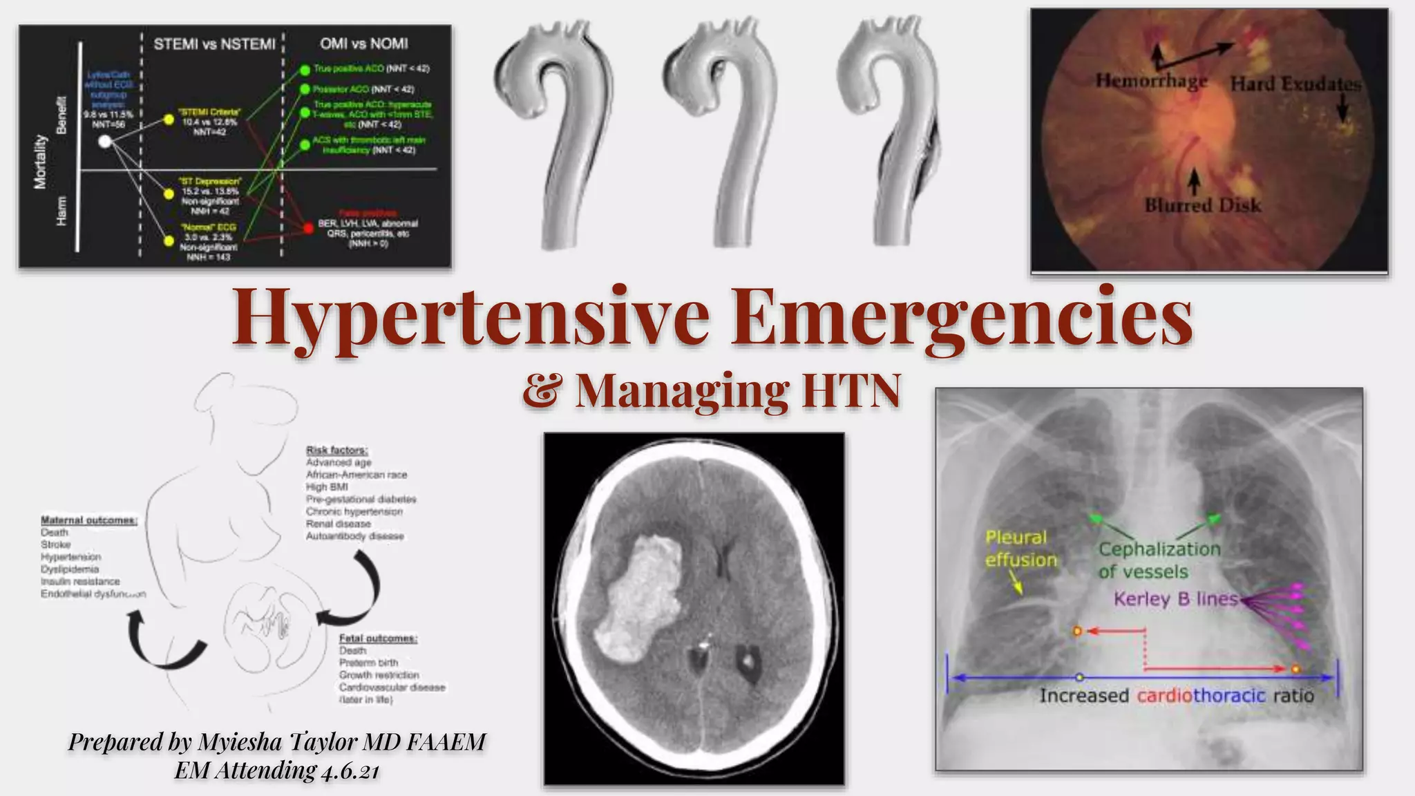 Hypertensive emergencies | PPTX