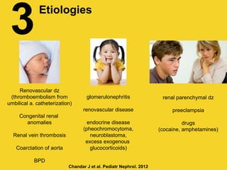 3Etiologies
Renovascular dz
(thromboembolism from
umbilical a. catheterization)
Congenital renal
anomalies
Renal vein thrombosis
Coarctation of aorta
BPD
glomerulonephritis
renovascular disease
endocrine disease
(pheochromocytoma,
neuroblastoma,
excess exogenous
glucocorticoids)
renal parenchymal dz
preeclampsia
drugs
(cocaine, amphetamines)
Chandar J et al. Pediatr Nephrol. 2012
 